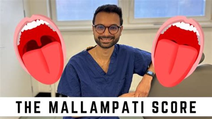 What is the Mallampati test?